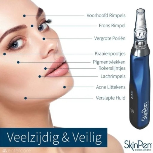 Microneedling behandeling Skin pen
