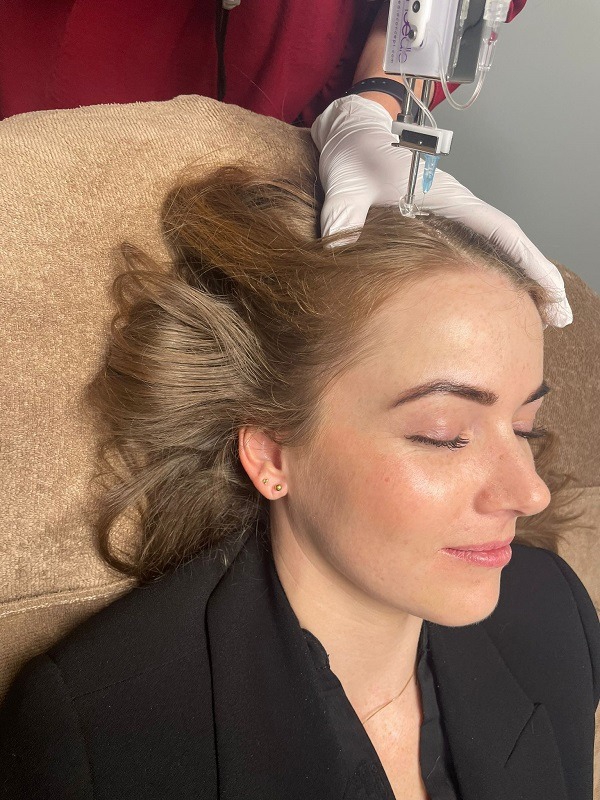 Mesotherapie haarbehandeling