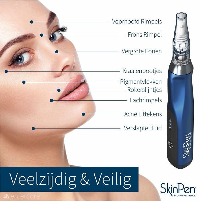 Huidverbetering Skinpen